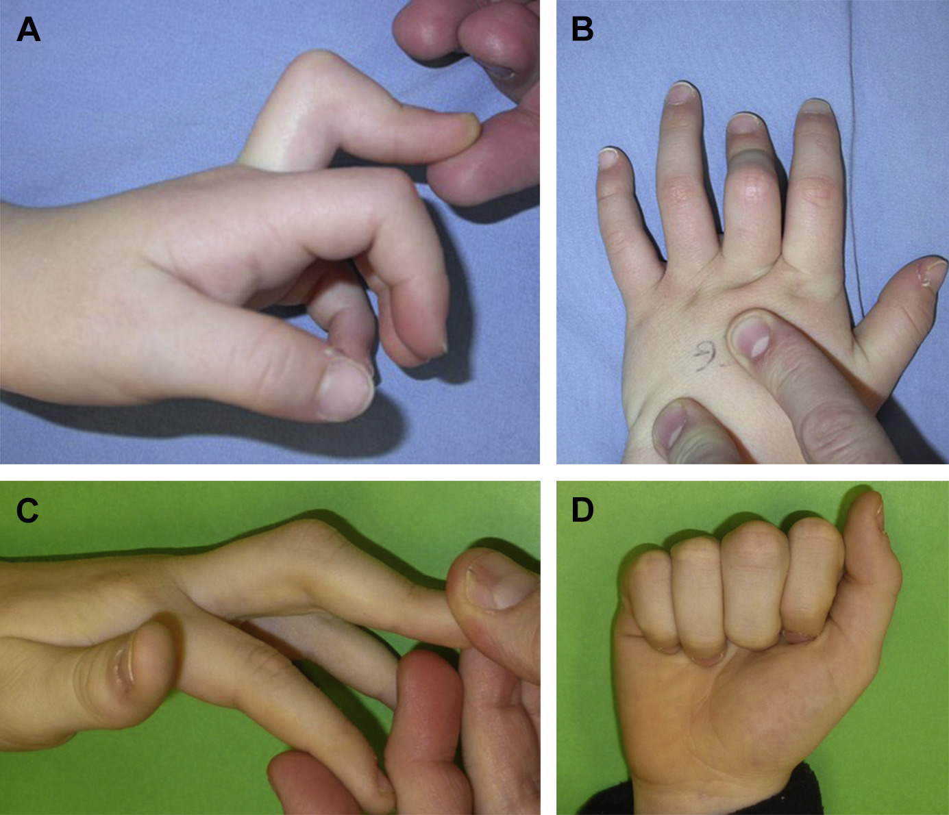 orthopedic doctor in patna, best orthopedic doctor in patna, top orthopedic doctor in patna, top ten orthopedic doctor in patna, bone doctor in patna, bone specialist in patna, best bone doctor in patna.